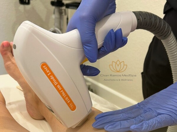Laser hair removal treatment at Chan Ramos MedSpa in Round Rock, TX