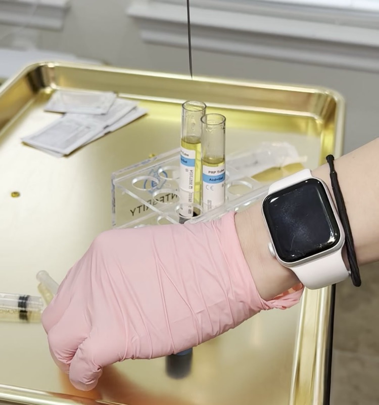 Golden PRP plasma separated in labeled vials on gold instrument tray